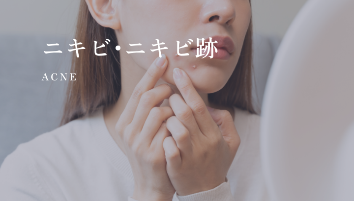 ニキビ･ニキビ跡